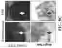 Fig. 11 - Targeted nanogels for urinary bladder therapies