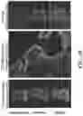 Fig. 14 - Targeted nanogels for urinary bladder therapies