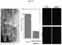 Fig. 11 - Composition for hepatic arterial chemoembolization using human serum albumin nanoparticles carrying anticancer agent, and method for producing same