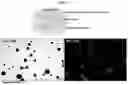 Fig. 12 - Composition for hepatic arterial chemoembolization using human serum albumin nanoparticles carrying anticancer agent, and method for producing same