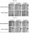 Fig. 02 - Pharmaceutical composition comprising gallstone solubilizer for treatment of gallbladder disease