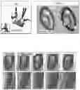 Fig. 01 - RAPIDLY IMPROVING VASCULAR CONDITIONS BY ADMINISTERING VITAMIN K