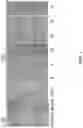 Fig. 06 - Andrographolide derivatives and method of using the same for treatment or prevention of fibrosis
