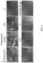 Fig. 08 - Andrographolide derivatives and method of using the same for treatment or prevention of fibrosis