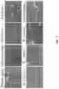 Fig. 12 - Andrographolide derivatives and method of using the same for treatment or prevention of fibrosis