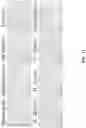 Fig. 14 - Andrographolide derivatives and method of using the same for treatment or prevention of fibrosis