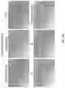Fig. 18 - Andrographolide derivatives and method of using the same for treatment or prevention of fibrosis