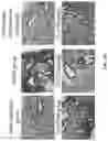 Fig. 33 - Andrographolide derivatives and method of using the same for treatment or prevention of fibrosis