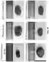 Fig. 43 - Andrographolide derivatives and method of using the same for treatment or prevention of fibrosis