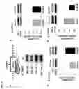Fig. 12 - 20-HETE receptor (GPR75) antagonists and methods of use