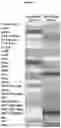 Fig. 08 - Inulin for preventing antibiotic resistant infection and pathogen colonization