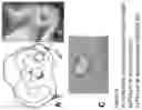 Fig. 02 - Composition for treating fibrocartilage tissue damage