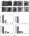 Fig. 11 - A POLYMER NETWORK, METHOD FOR PRODUCTION, AND USES THEREOF