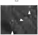 Fig. 22 - Cellular targeted active ingredient delivery system