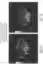 Fig. 08 - THERAPY AND METHODS OF INTRODUCING IMMATURE DENDRITIC CELLS AND/OR CYTOXIC T LYMPHOCYTE AND ANTI PD-1 / PD-L1 ANTIBODY FOR TREATMENT OF TUMORS