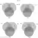 Fig. 26 - COMPOSITIONS FOR MODIFYING GUT MICROBIOTA