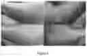 Fig. 02 - SKIN CARE COMPOSITION