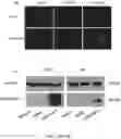 Fig. 16 - TERT immunogenic compositions and methods of treatment using the same