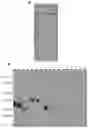Fig. 01 - Malaria vaccine and methods for producing same