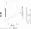 Fig. 15 - METHODS OF TREATING LUNG CANCER WITH A PD-1 AXIS BINDING ANTAGONIST, A PLATINUM AGENT, AND A TOPOISOMERASE II INHIBITOR