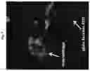 Fig. 10 - Cellular Targeted Label Delivery System