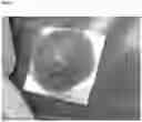 Fig. 03 - Hemostatic sponge