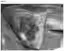 Fig. 04 - Hemostatic sponge