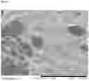Fig. 07 - Hemostatic sponge