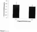 Fig. 02 - Tissue engineering scaffolds comprising particulate egg shell membrane