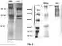 Fig. 04 - Extracellular matrix-derived gels and related methods