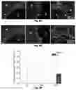 Fig. 06 - Biodegradable, porous, thermally responsive injectable hydrogel as soft tissue defect filler