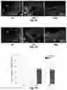 Fig. 08 - Biodegradable, porous, thermally responsive injectable hydrogel as soft tissue defect filler