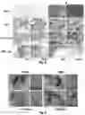 Fig. 10 - Biodegradable, porous, thermally responsive injectable hydrogel as soft tissue defect filler
