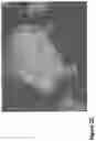 Fig. 09 - Nanofiber-hydrogel composites for cell and tissue delivery
