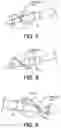 Fig. 07 - Intravascular pump without inducer and centrifugal force-driven expansion of impeller blades and/or expandable and collapsible impeller housing