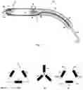 Fig. 02 - Blood pump