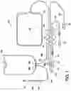 Fig. 03 - Dialysis and methods including sensor feedback to improve patient experience