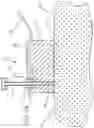 Fig. 07 - Subcutaneous access hub with multiple cannula ports
