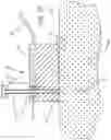 Fig. 09 - Subcutaneous access hub with multiple cannula ports