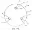 Fig. 12 - Subcutaneous access hub with multiple cannula ports
