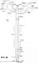 Fig. 02 - MEDICAL TUBES FOR SELECTIVE MECHANICAL VENTILATION OF THE LUNGS