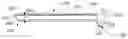 Fig. 01 - EXPANDABLE ENDOTRACHEAL DEVICE