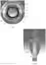 Fig. 06 - ENDOTRACHEAL INTUBATION DEVICE