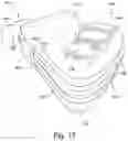 Fig. 18 - Cushion to frame assembly mechanism