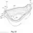 Fig. 23 - Cushion to frame assembly mechanism