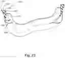 Fig. 24 - Cushion to frame assembly mechanism