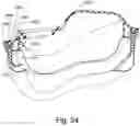 Fig. 25 - Cushion to frame assembly mechanism