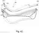 Fig. 40 - Cushion to frame assembly mechanism