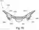 Fig. 66 - Cushion to frame assembly mechanism