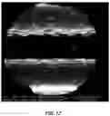 Fig. 20 - Medical components with microstructures for humidification and condensate management